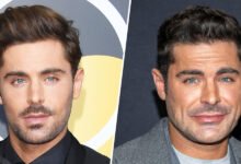 Zac Efron Face Surgery