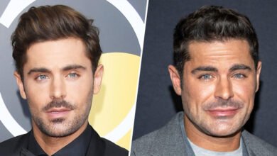 Zac Efron Face Surgery